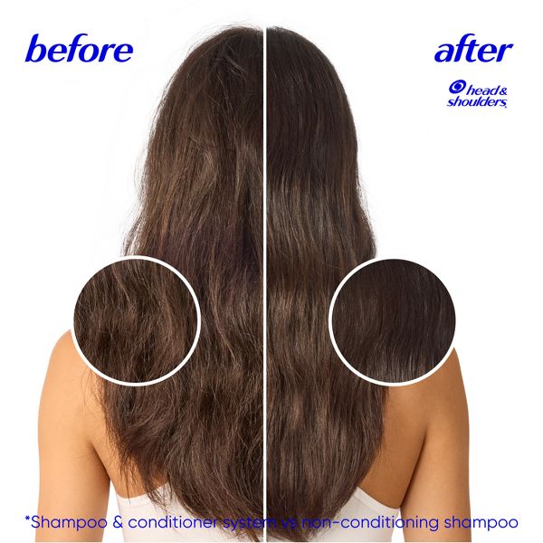 Head & Shoulders 2-in-1 Dandruff Shampoo and Conditioner, Anti-Dandruff Treatment, Dry Scalp Care for Daily Use, Paraben-Free - 12.5 fl oz