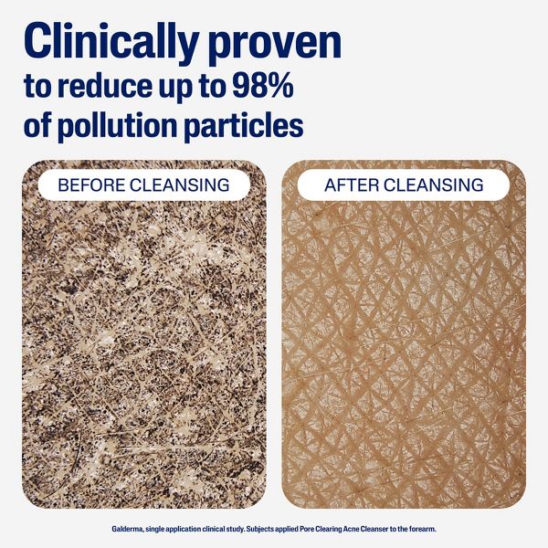 Cetaphil Gentle Clear Pore Cleansing 2% Salicylic Acid Acne Treatment Face Wash - 8 fl oz