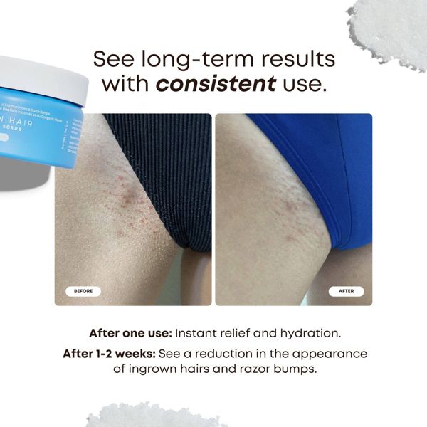 Bushbalm Nude Ingrown Hair Exfoliating Scrub - 8 fl oz