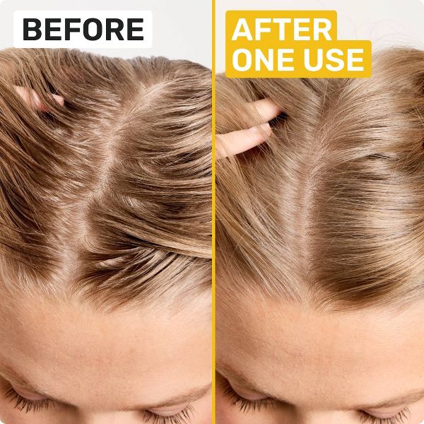 Ethique Beauty Clarifying Shampoo Bar for oily hair with Castor Oil
