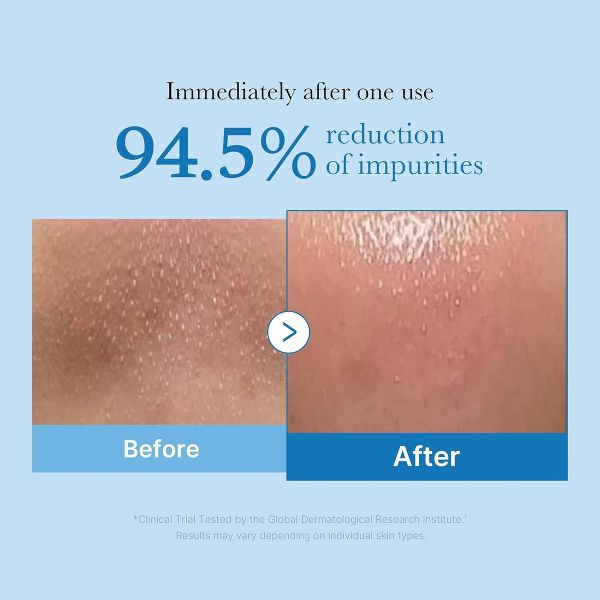 medicube Korean Skincare Zero Blackhead Face Cleansing Oil - 205ml