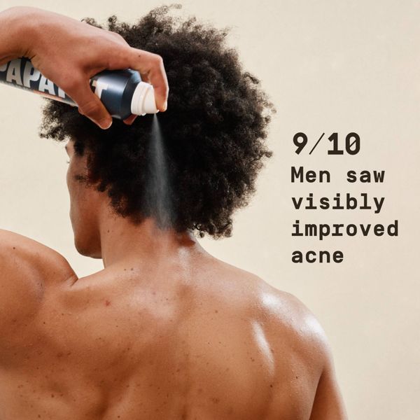 Papatui Men's Body Acne Spray for Back & Body Breakouts - 6oz