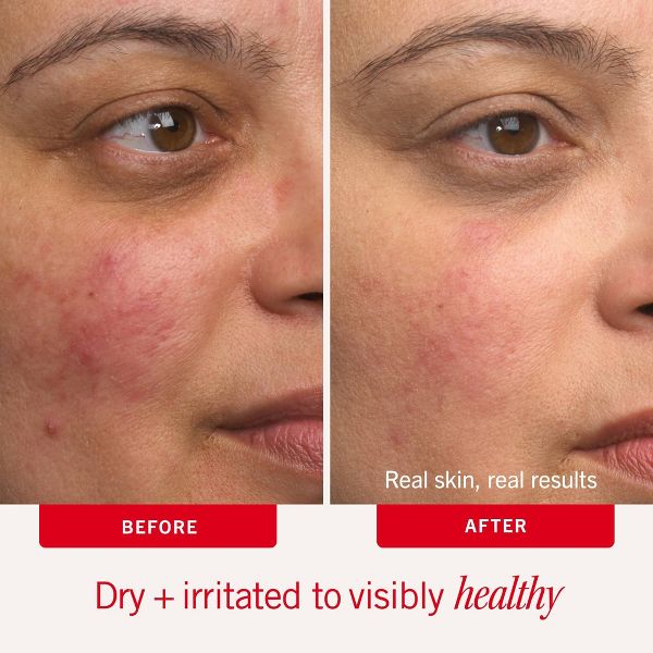 FIRST AID BEAUTY Ultra Repair Cream with Colloidal Oatmeal - 12.0oz - Beauty Studio