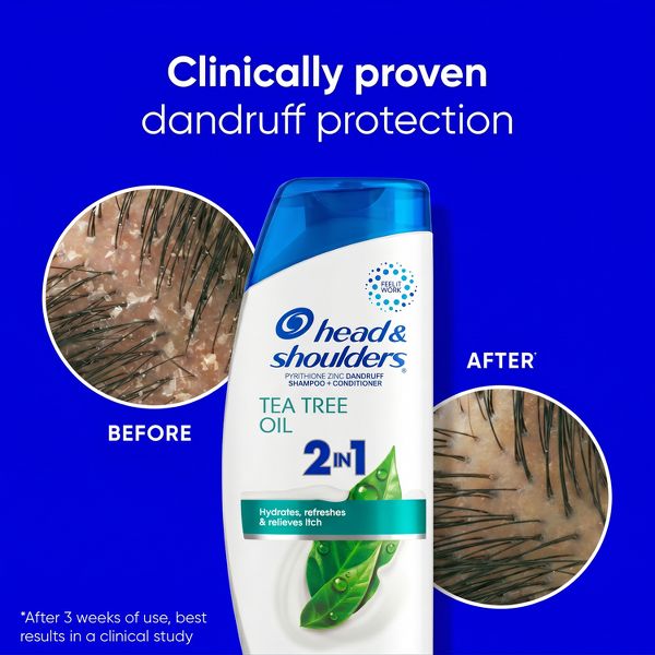 Head & Shoulders Dandruff Treatment/Dandruff Shampoo and Conditioner with Tea Tree Oil - 12.5 fl oz