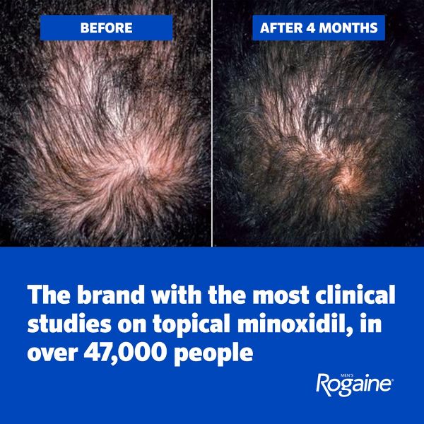 Rogaine Men's Hair Treatment Solution - Trial Size - 2 fl oz/3pk