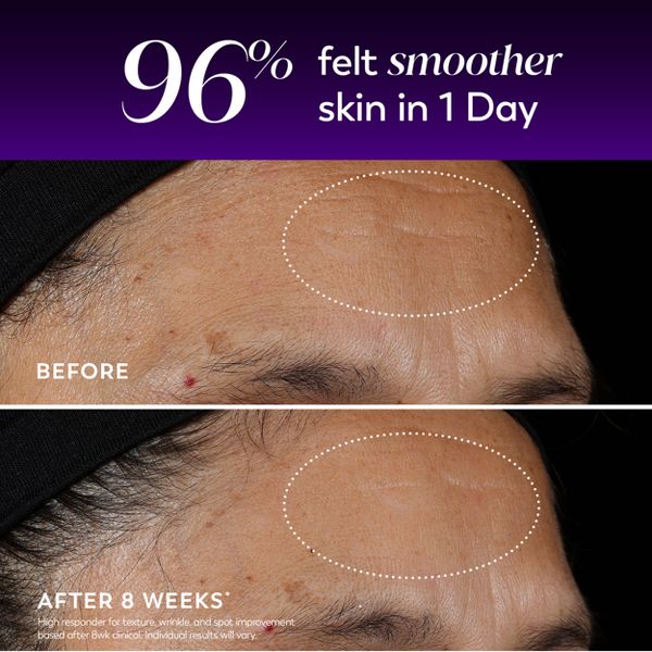 Olay Regenerist Anti-Aging Night Serum, Hydrating & Wrinkle Correcting Treatment - 1 fl oz