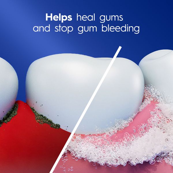 Crest Pro-Health Gum Detoxify Gentle Whitening Toothpaste - 4.8oz