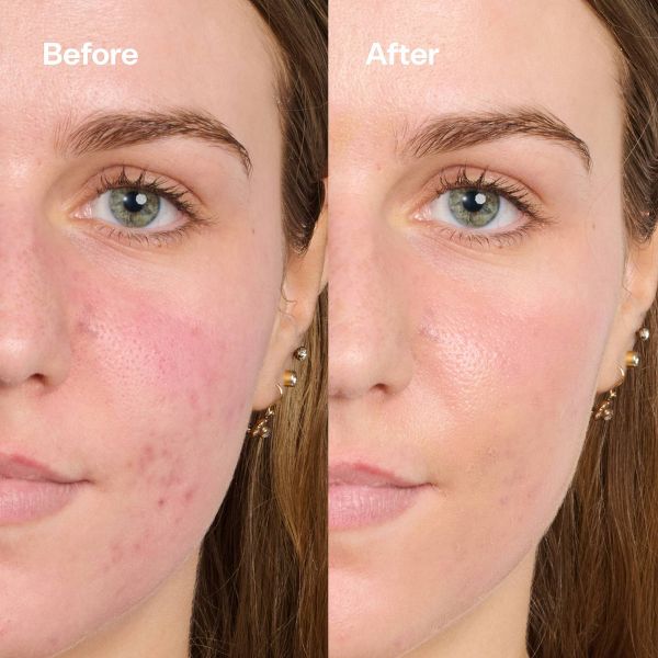 Bubble Skincare Secret Agent Color Correcting Balm Redness Fix - 0.5oz