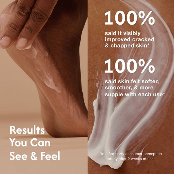 Ontu Hands & Foot 15% Urea Moisturizing Treatment Cream with Glycolic Acid - 3.4oz