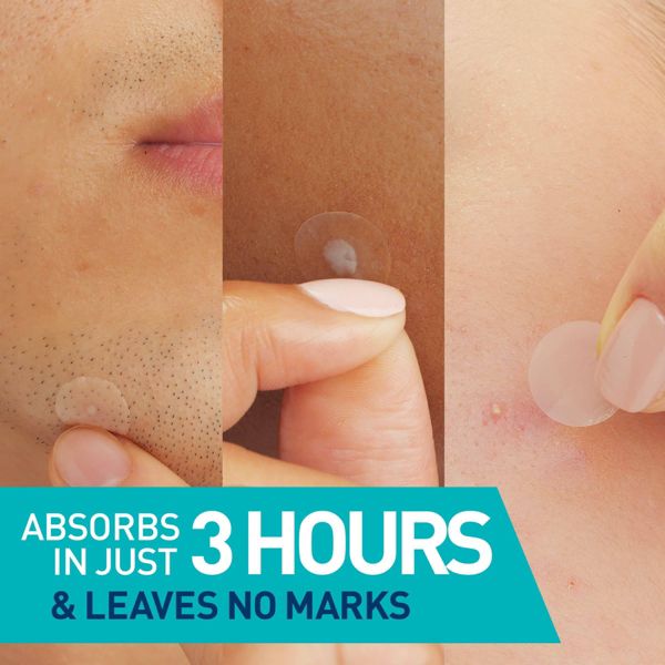 CeraVe Acne Control Patches - 22ct