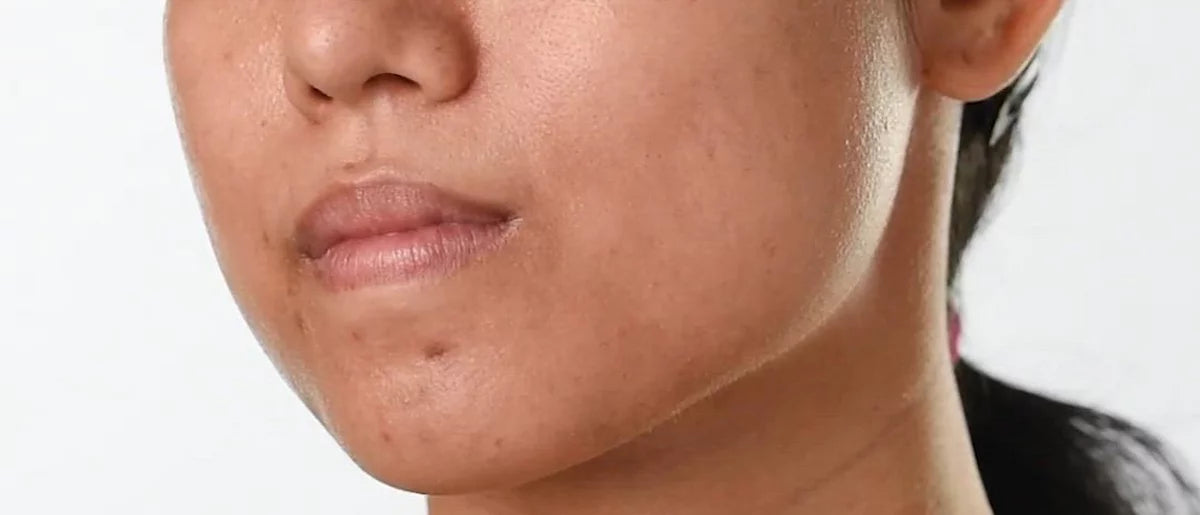 Minimalist Multi-Peptides 10% Face Serum - 1 fl oz
