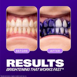 Hismile V34 Tooth Whitening Colour Corrector Serum - 30ml