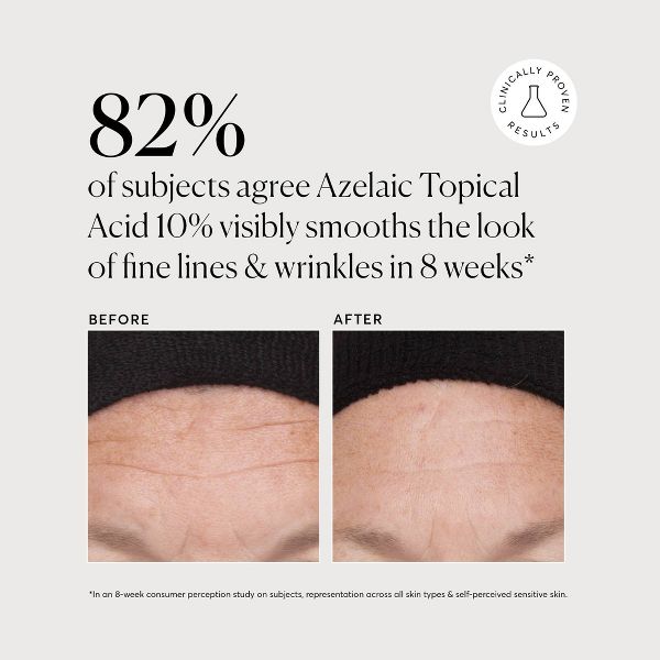 Naturium Azelaic Topical Acid 10% - 1 fl oz