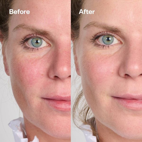 Bubble Skincare Secret Agent Color Correcting Balm Redness Fix - 0.5oz