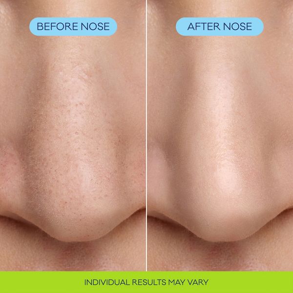 Biore Pore Minimizing Bubbling Face Mask Nose Strips - 8ct