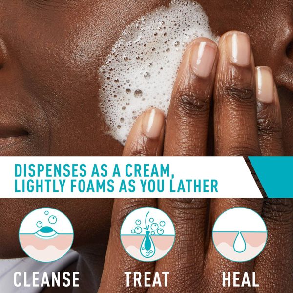 CeraVe Acne Foaming Cream Face Cleanser, Acne Treatment Face Wash - Fragrance-Free - 5oz