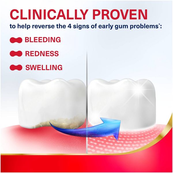 Parodontax Active Gum Repair Fluoride Toothpaste - Fresh Mint - 3.4oz