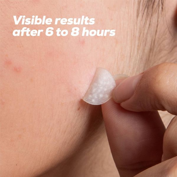 HANHOO On The Go Blemish Patch - 108ct