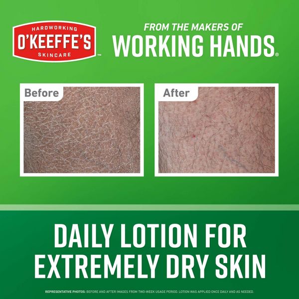 O'Keeffe's Working Hands Hand & Body Lotion - 12oz