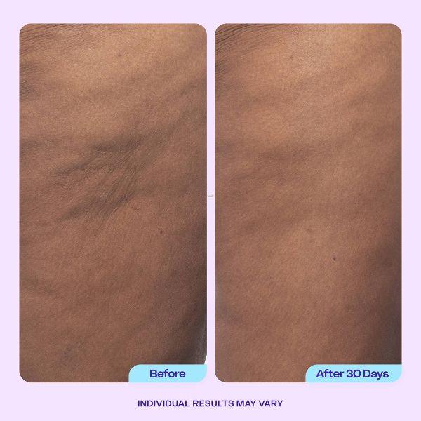 goPure Firming Butt & Thigh Cream - 4.25 fl oz