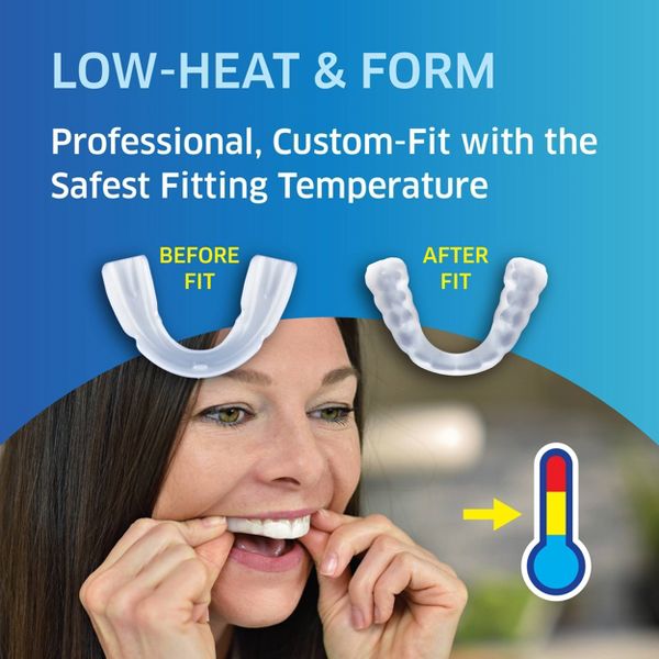 SleepRight ProRx Custom Full Coverage Dental Guard