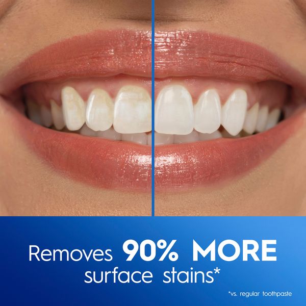 Crest 3DWhite Advanced Teeth Whitening Toothpaste - Radiant Mint - 3.3oz/4pk