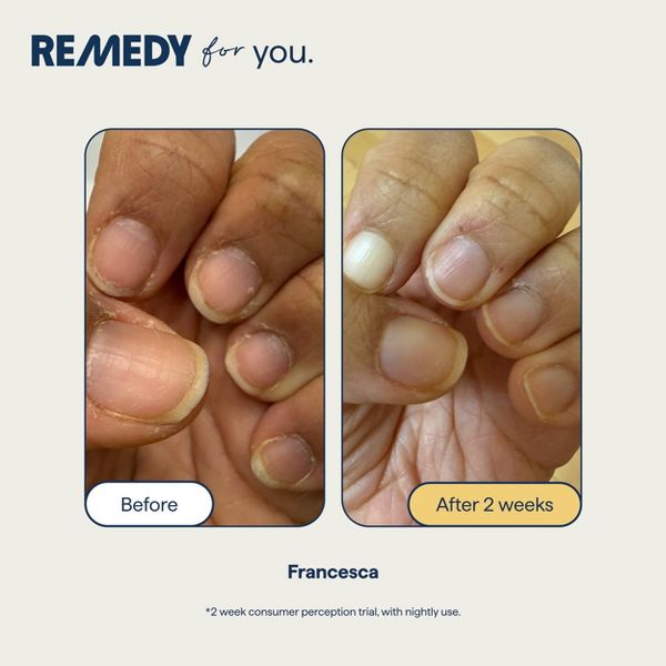 Remedy Skin Hand & Cuticle Firming Whipped Cream with Peptides - 2.25oz