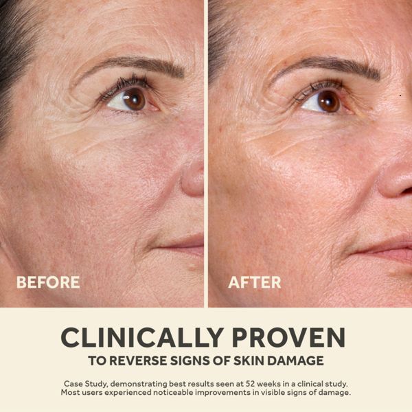 No7 Future Renew Damage Reversal Face Serum - 0.85 fl oz