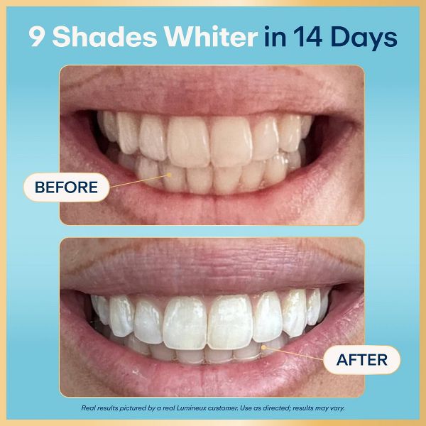 Lumineux Tooth Whitening Strips - 14pk
