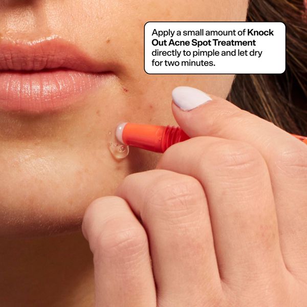 Bubble Skincare Knock Out Salicylic Acid Spot Treatment - 0.33 fl oz