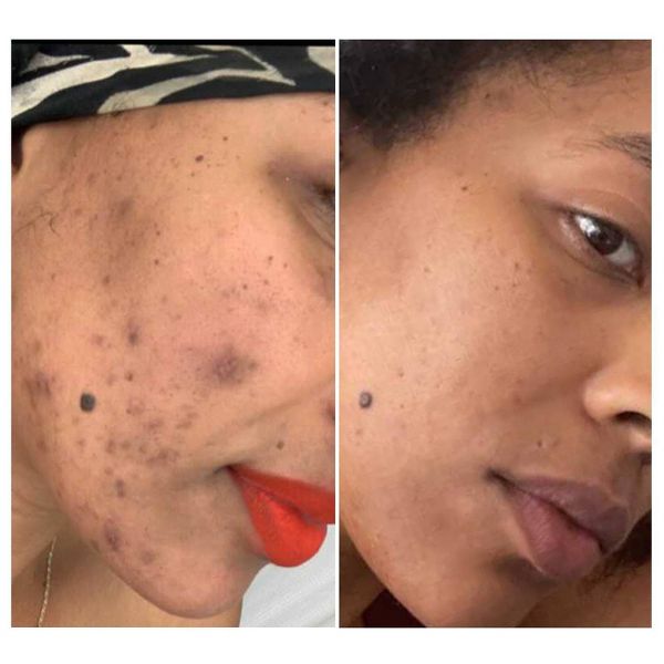 Urban Skin Rx Retinol Rapid Repair and Dark Spot Treatment - 1 fl oz